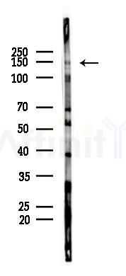Phospho-EGFR (Tyr1048)[Tyr1172] Antibody - Western blot analysis of lysates from HUVEC cells(starvation 24h treatment), using Phospho-EGFR (Tyr1048)[Tyr1172] Antibody at 1/1000 dilution.
