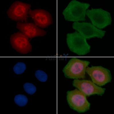 Phospho-Estrogen Receptor alpha (Ser167) Antibody - AF3057 staining Hela cells(30min of UV treatment) by IF/ICC.