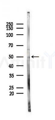 Phospho-p53 (Ser9) Antibody - Western blot analysis of lysates from 293 cells(starvation 24h treatment), using Phospho-p53 (Ser9) Antibody at 1/1000 dilution.