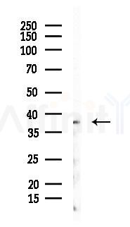 Phospho-eIF2 alpha (Ser51)[Ser52] Antibody - Western blot analysis of lysates from B16F10-LUC cells(LPS 4h treatment), using Phospho-eIF2 alpha (Ser51)[Ser52] Antibody at 1/1000 dilution.