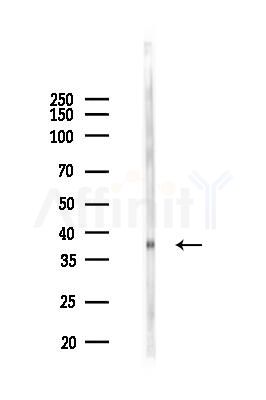 Phospho-eIF2 alpha (Ser51)[Ser52] Antibody - Western blot analysis of lysates from Rat spleen, using Phospho-eIF2 alpha (Ser51)[Ser52] Antibody at 1/1000 dilution.