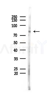 Phospho-PKC beta 1 (Ser661) Antibody - Western blot analysis of lysates from HUVEC cells(starvation 24h treatment), using Phospho-PKC beta 1 (Ser661) Antibody at 1/1000 dilution.