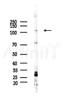 Phospho-ATP1A1 (Ser23) Antibody - Western blot analysis of lysates from PC12 cells(heat-shock 45min treatment), using Phospho-ATP1A1 (Ser23) Antibody at 1/1000 dilution.