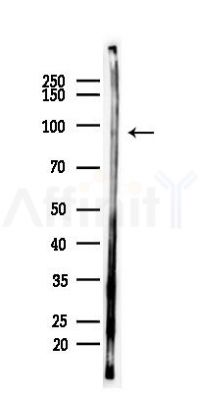 Phospho-IGF1R/Insulin Receptor (Tyr1161/Tyr1185) Antibody - Western blot analysis of lysates from Mouse liver, using Phospho-IGF1R/Insulin Receptor (Tyr1161/Tyr1185) Antibody at 1/1000 dilution.