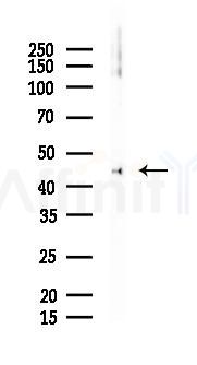 Phospho-Tau (Ser396) Antibody - Western blot analysis of lysates from K562 cells(LPS 4h treatment), using Phospho-Tau (Ser396) Antibody at 1/1000 dilution.