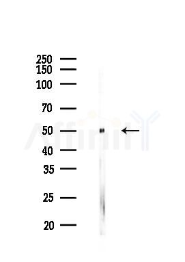 Phospho-Tau (Ser262)[Ser579] Antibody - Western blot analysis of lysates from Rat testis, using Phospho-Tau (Ser262)[Ser579] Antibody at 1/1000 dilution.