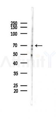 Phospho-SRF (Ser99)[Ser103] Antibody - Western blot analysis of lysates from HUVEC cells(starvation 24h treatment), using Phospho-SRF (Ser99)[Ser103] Antibody at 1/1000 dilution.
