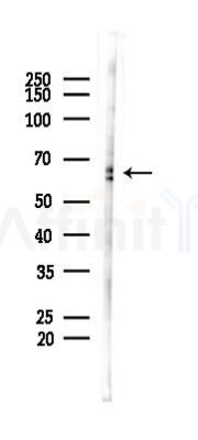 Phospho-SRF (Ser99)[Ser103] Antibody - Western blot analysis of lysates from 293 cells(starvation 24h treatment), using Phospho-SRF (Ser99)[Ser103] Antibody at 1/1000 dilution.