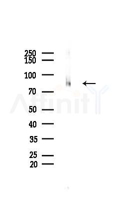 Phospho-Glycogen Synthase (Ser645) Antibody - Western blot analysis of lysates from Rat muscle, using Phospho-Glycogen Synthase (Ser645) Antibody at 1/1000 dilution.
