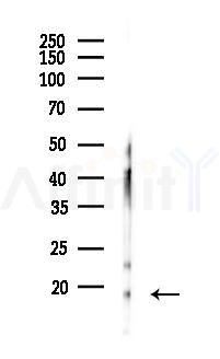Phospho-Histone H2A.X (Ser139)[Ser140] Antibody - Western blot analysis of lysates from K562 cells(LPS 4h treatment), using Phospho-Histone H2A.