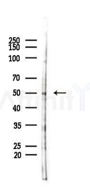 Phospho-Epo-R (Tyr368) Antibody - Western blot analysis of lysates from HUVEC cells(starvation 24h treatment), using Phospho-Epo-R (Tyr368) Antibody at 1/1000 dilution.