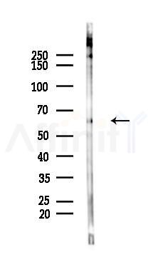 Phospho-ELK1 (Ser383) Antibody - Western blot analysis of lysates from Mouse lung, using Phospho-ELK1 (Ser383) Antibody at 1/1000 dilution.