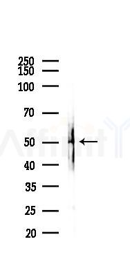 Phospho-ELK1 (Ser383) Antibody - Western blot analysis of lysates from B16F10-LUC cells(heat-shock 45min treatment), using Phospho-ELK1 (Ser383) Antibody at 1/1000 dilution.