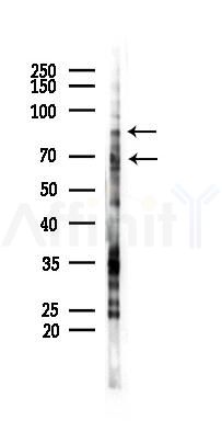 Phospho-p70 S6 Kinase (Thr389/Thr412) Antibody - Western blot analysis of lysates from HUVEC cells(starvation 24h treatment), using Phospho-p70 S6 Kinase (Thr389/Thr412) Antibody at 1/1000 dilution.
