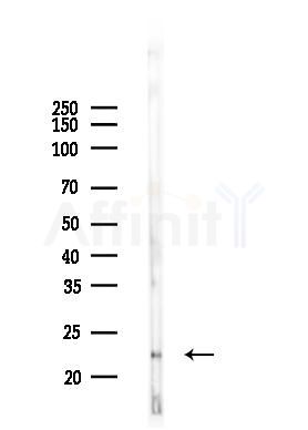 Phospho-Cofilin (Ser3) Antibody - Western blot analysis of lysates from Mouse brain, using Phospho-Cofilin (Ser3) Antibody at 1/1000 dilution.