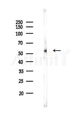 Phospho-AKT1 (Ser129) Antibody - Western blot analysis of lysates from Rat brain, using Phospho-AKT1 (Ser129) Antibody at 1/1000 dilution.