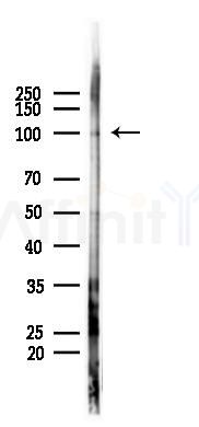 Phospho-beta Catenin (Ser37) Antibody - Western blot analysis of lysates from HUVEC cells(starvation 24h treatment), using Phospho-beta Catenin (Ser37) Antibody at 1/1000 dilution.