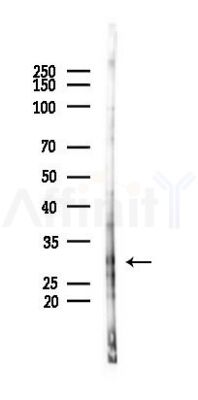 Phospho-DDIT3/CHOP (Ser30) Antibody - Western blot analysis of lysates from HUVEC cells(starvation 24h treatment), using Phospho-DDIT3/CHOP (Ser30) Antibody at 1/1000 dilution.
