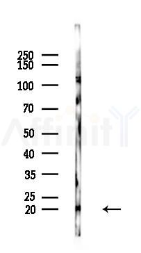 Phospho-Synuclein alpha (Ser129) Antibody - Western blot analysis of lysates from PC12 cells(LPS 4h treatment), using Phospho-Synuclein alpha (Ser129) Antibody at 1/1000 dilution.