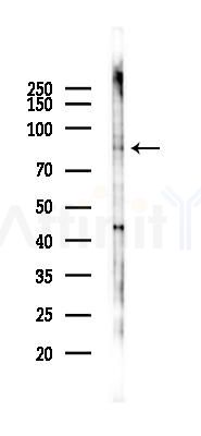 Phospho-STAT3 (Tyr705) Antibody - Western blot analysis of lysates from COLO205 cells(heat-shock 45min treatment), using Phospho-STAT3 (Tyr705) Antibody at 1/1000 dilution.