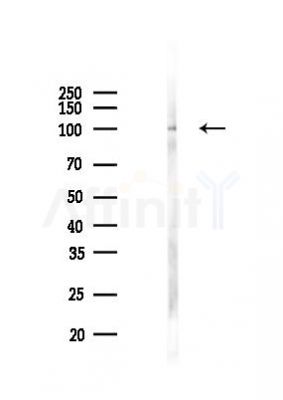 Phospho-STAT5 (Tyr694) Antibody - Western blot analysis of lysates from K562 cells(LPS 4h treatment), using Phospho-STAT5 (Tyr694) Antibody at 1/1000 dilution.