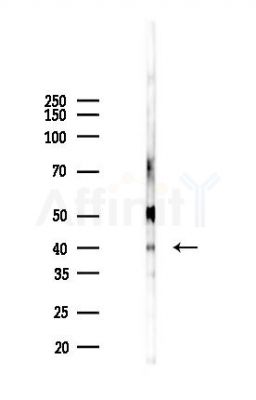 Phospho-Caspase 3 (Ser150) Antibody - Western blot analysis of lysates from A2780 cells(LPS 4h treatment), using Phospho-Caspase 3 (Ser150) Antibody at 1/1000 dilution.