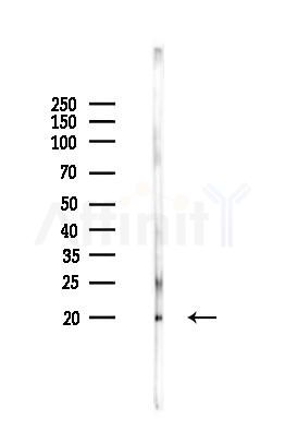 Phospho-Caspase 3 (Ser150) Antibody - Western blot analysis of lysates from Rat testis, using Phospho-Caspase 3 (Ser150) Antibody at 1/1000 dilution.