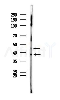 Phospho-JNK1/2/3 (Tyr185) Antibody - Western blot analysis of lysates from HUVEC cells(UV 30min treatment), using Phospho-JNK1/2/3 (Tyr185) Antibody at 1/1000 dilution.