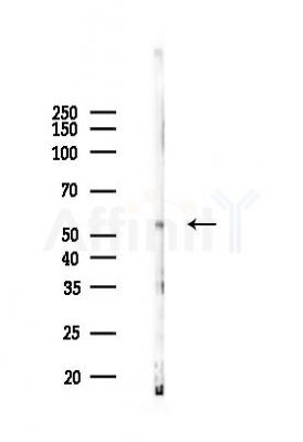 Phospho-YAP (Ser127) Antibody - Western blot analysis of lysates from 293 cells(UV 30min treatment), using Phospho-YAP (Ser127) Antibody at 1/1000 dilution.