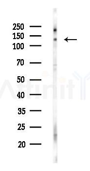 Phospho-p130 Cas (Tyr410) Antibody - Western blot analysis of lysates from PC12 cells(heat-shock 45min treatment), using Phospho-p130 Cas (Tyr410) Antibody at 1/1000 dilution.
