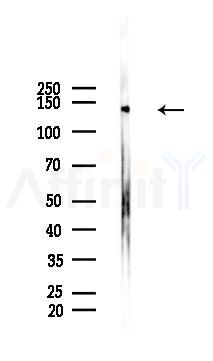 Phospho-ADAM 17 (Thr735) Antibody - Western blot analysis of lysates from PC12 cells(LPS 4h treatment), using Phospho-ADAM 17 (Thr735) Antibody at 1/1000 dilution.