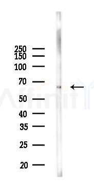 Phospho-NF-kB p65 (Ser276) Antibody - Western blot analysis of lysates from A2780 cells(LPS 4h treatment), using Phospho-NF-kB p65 (Ser276) Antibody at 1/1000 dilution.