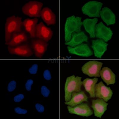 Phospho-NF-kB p65 (Ser529) Antibody - AF3388 staining Hela cells(30min of UV treatment) by IF/ICC.