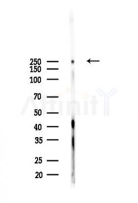 Phospho-ACC1 (Ser79)[Ser80] Antibody - Western blot analysis of lysates from Rat testis, using Phospho-ACC1 (Ser79)[Ser80] Antibody at 1/1000 dilution.
