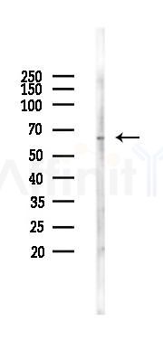 Phospho-AMPK alpha (Thr172) Antibody - Western blot analysis of lysates from Hela cells(starvation 24h treatment), using Phospho-AMPK alpha (Thr172) Antibody at 1/1000 dilution.
