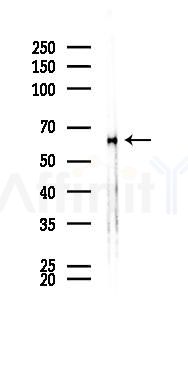 Phospho-AMPK alpha (Thr172) Antibody - Western blot analysis of lysates from Mouse brain, using Phospho-AMPK alpha (Thr172) Antibody at 1/1000 dilution.