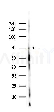 Phospho-AMPK alpha (Thr172) Antibody - Western blot analysis of lysates from Mouse kidney, using Phospho-AMPK alpha (Thr172) Antibody at 1/1000 dilution.