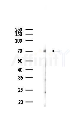 Phospho-PAK1 (Thr212) Antibody - Western blot analysis of lysates from Mouse lung, using Phospho-PAK1 (Thr212) Antibody at 1/1000 dilution.
