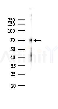 Phospho-CaMKII beta/ gamma/ delta (Thr287) Antibody - Western blot analysis of lysates from Mouse lung, using Phospho-CaMKII beta/ gamma/ delta (Thr287) Antibody at 1/1000 dilution.