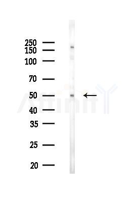 Phospho-CaMKII beta/ gamma/ delta (Thr287) Antibody - Western blot analysis of lysates from PC12 cells(heat-shock 45min treatment), using Phospho-CaMKII beta/ gamma/ delta (Thr287) Antibody at 1/1000 dilution.