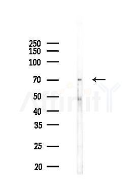 Phospho-CaMKII beta/ gamma/ delta (Thr287) Antibody - Western blot analysis of lysates from Rat brain, using Phospho-CaMKII beta/ gamma/ delta (Thr287) Antibody at 1/1000 dilution.