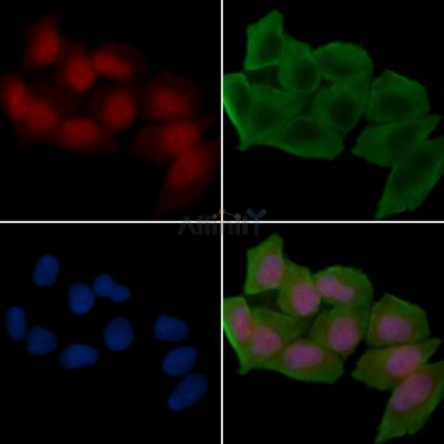 Phospho-SMC1 (Ser957) Antibody - AF3439 staining Hela cells(30min of UV treatment) by IF/ICC.