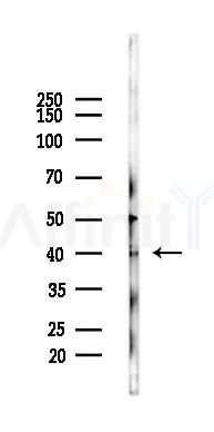 Phospho-p38 MAPK (Tyr182) Antibody - Western blot analysis of lysates from HUVEC cells(UV 30min treatment), using Phospho-p38 MAPK (Tyr182) Antibody at 1/1000 dilution.