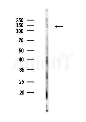 Phospho-Trk B (Tyr516) Antibody - Western blot analysis of lysates from COLO205 cells(heat-shock 45min treatment), using Phospho-Trk B (Tyr516) Antibody at 1/1000 dilution.