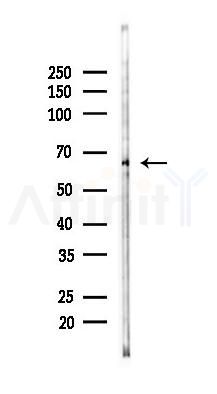 Phospho-FRS2 (Tyr436) Antibody - Western blot analysis of lysates from COLO205 cells(heat-shock 45min treatment), using Phospho-FRS2 (Tyr436) Antibody at 1/1000 dilution.