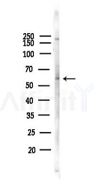 Phospho-CaMKII alpha/delta (Thr286) Antibody - Western blot analysis of lysates from Hela cells(starvation 24h treatment), using Phospho-CaMKII alpha/delta (Thr286) Antibody at 1/1000 dilution.