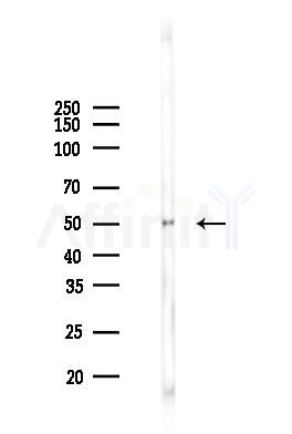 Phospho-CaMKII alpha/delta (Thr286) Antibody - Western blot analysis of lysates from Mouse testis, using Phospho-CaMKII alpha/delta (Thr286) Antibody at 1/1000 dilution.