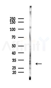 Phospho-AMPK beta 1 (Ser181) Antibody - Western blot analysis of lysates from Rat liver, using Phospho-AMPK beta 1 (Ser181) Antibody at 1/1000 dilution.