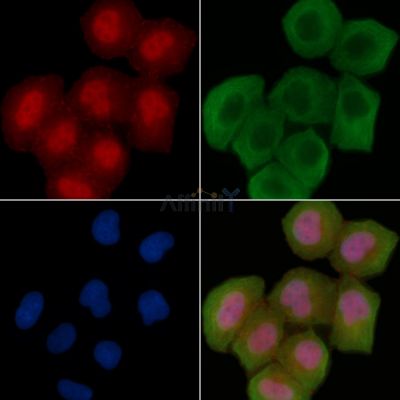 Phospho-ZO-2 (Tyr1118) Antibody - AF3518 staining Hela cells(30min of UV treatment) by IF/ICC.