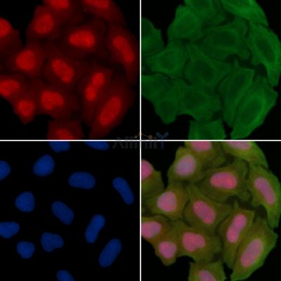 Phospho-RAD18 (Ser471) Antibody - AF3530 staining Hela cells(30min of UV treatment) by IF/ICC.